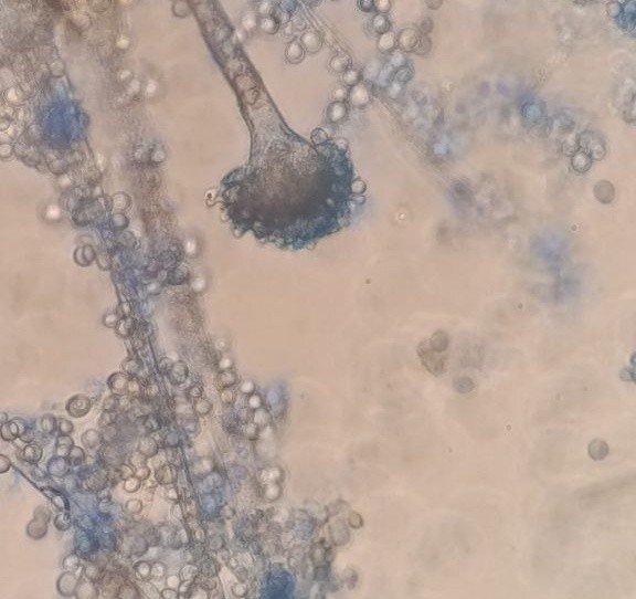 Aspergillus oryzae conidioforo y esporas